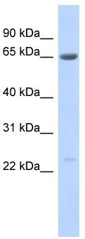 WB Suggested Anti-SSX7 Antibody Titration: 0.2-1 ug/ml; ELISA Titer: 1: 62500; Positive Control: Human Pancreas