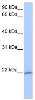 WB Suggested Anti-ZNF252P-AS1 Antibody Titration: 0.2-1 ug/ml; Positive Control: 721_B cell lysate