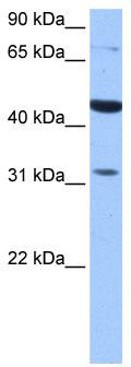 WB Suggested Anti-TPRXL Antibody Titration: 0.2-1 ug/ml; Positive Control: HepG2 cell lysate