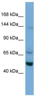 WB Suggested Anti-TRIM66 Antibody Titration: 0.2-1 ug/ml; ELISA Titer: 1: 62500; Positive Control: A549 cell lysate