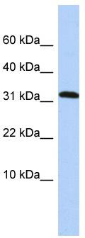 WB Suggested Anti-DYSFIP1 Antibody Titration: 0.2-1 ug/ml; ELISA Titer: 1: 12500; Positive Control: HepG2 cell lysate