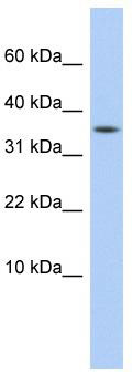 WB Suggested Anti-DYSFIP1 Antibody Titration: 0.2-1 ug/ml; ELISA Titer: 1: 12500; Positive Control: HepG2 cell lysate
