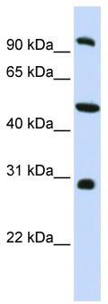WB Suggested Anti-EML1 Antibody Titration: 0.2-1 ug/ml; ELISA Titer: 1: 62500; Positive Control: HepG2 cell lysate