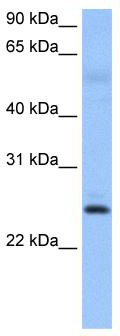 WB Suggested Anti-ROPN1B Antibody Titration: 0.2-1 ug/ml; Positive Control: Human Muscle