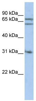 WB Suggested Anti-GPHN Antibody Titration: 0.2-1 ug/ml; ELISA Titer: 1: 62500; Positive Control: Jurkat cell lysate