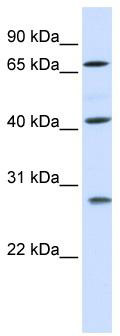WB Suggested Anti-RDM1 Antibody Titration: 0.2-1 ug/ml; ELISA Titer: 1: 62500; Positive Control: Human Placenta