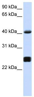 WB Suggested Anti-SERPINA3 Antibody Titration: 0.2-1 ug/ml; ELISA Titer: 1: 62500; Positive Control: 721_B cell lysate
