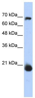 WB Suggested Anti-CHCHD4 Antibody Titration: 0.2-1 ug/ml; ELISA Titer: 1: 62500; Positive Control: Transfected 293T