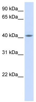 WB Suggested Anti-FAM54A Antibody Titration: 0.2-1 ug/ml; ELISA Titer: 1: 12500; Positive Control: Human Muscle