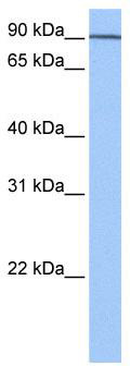 WB Suggested Anti-AP1G1 Antibody Titration: 0.2-1 ug/ml; Positive Control: Human brain