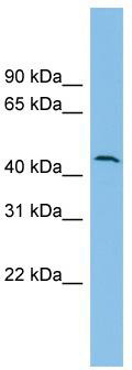 WB Suggested Anti-DPH1 Antibody Titration: 0.2-1 ug/ml; ELISA Titer: 1: 1562500; Positive Control: RPMI 8226 cell lysate