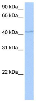 WB Suggested Anti-DPH1 Antibody Titration: 0.2-1 ug/ml; Positive Control: MCF7 cell lysate DPH1 is supported by BioGPS gene expression data to be expressed in MCF7