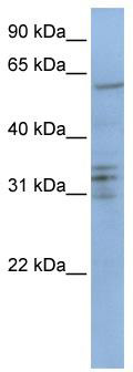 WB Suggested Anti-CENPB Antibody Titration: 0.2-1 ug/ml; ELISA Titer: 1: 500; Positive Control: Jurkat cell lysate