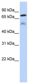 WB Suggested Anti-DUSP8 Antibody Titration: 0.2-1 ug/ml; ELISA Titer: 1: 2500; Positive Control: Transfected 293T