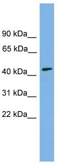 WB Suggested Anti-DOM3Z Antibody Titration: 0.2-1 ug/ml; Positive Control: COLO205 cell lysate