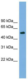 WB Suggested Anti-TUBB4 Antibody Titration: 0.2-1 ug/ml; Positive Control: Jurkat cell lysate