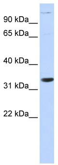 WB Suggested Anti-ANP32B Antibody Titration: 0.2-1 ug/ml; ELISA Titer: 1: 12500; Positive Control: Human Muscle