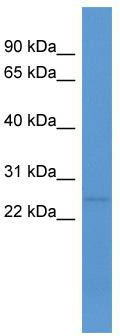 WB Suggested Anti-C1ql1 Antibody Titration: 0.2-1 ug/ml; ELISA Titer: 1: 12500; Positive Control: Mouse Spleen