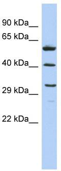 WB Suggested Anti-C1QTNF7 Antibody Titration: 0.2-1 ug/ml; ELISA Titer: 1: 62500; Positive Control: COLO205 cell lysate