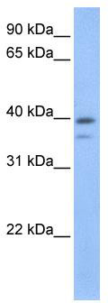 WB Suggested Anti-VPS26B Antibody Titration: 0.2-1 ug/ml; Positive Control: Human brain