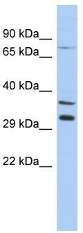 WB Suggested Anti-TSGA13 Antibody Titration: 0.2-1 ug/ml; ELISA Titer: 1: 312500; Positive Control: THP-1 cell lysate
