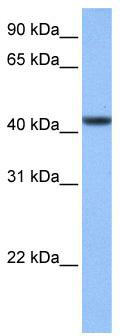 WB Suggested Anti-C8orf34 Antibody Titration: 0.2-1 ug/ml; Positive Control: Hela cell lysate