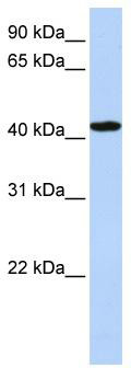 WB Suggested Anti-TADA1L Antibody Titration: 0.2-1 ug/ml; ELISA Titer: 1: 2500; Positive Control: Hela cell lysate