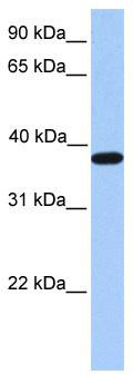 WB Suggested Anti-ACTRT2 Antibody Titration: 0.2-1 ug/ml; Positive Control: Human Muscle