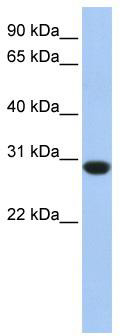 WB Suggested Anti-ASB12 Antibody Titration: 0.2-1 ug/ml; ELISA Titer: 1: 1562500; Positive Control: Human Muscle