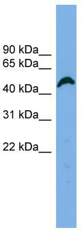 WB Suggested Anti-APBB3 Antibody Titration: 0.2-1 ug/ml; Positive Control: Hela cell lysate