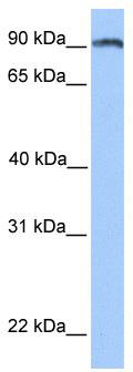 WB Suggested Anti-ANKS3 Antibody Titration: 0.2-1 ug/ml; Positive Control: Hela cell lysate