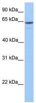 WB Suggested Anti-KIAA1958 Antibody Titration: 0.2-1 ug/ml; Positive Control: Hela cell lysate