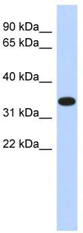 WB Suggested Anti-ACTRT1 Antibody Titration: 0.2-1 ug/ml; ELISA Titer: 1: 312500; Positive Control: Human Pancreas