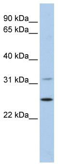 WB Suggested Anti-DHRS1 Antibody Titration: 0.2-1 ug/ml; ELISA Titer: 1: 62500; Positive Control: 721_B cell lysateDHRS1 is supported by BioGPS gene expression data to be expressed in 721_B