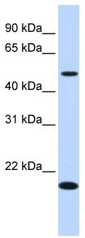 WB Suggested Anti-C5orf55 Antibody Titration: 0.2-1 ug/ml; ELISA Titer: 1: 62500; Positive Control: Human Liver