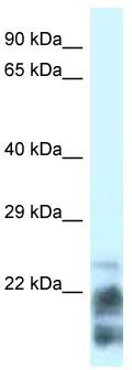WB Suggested Anti-MDP-1 Antibody Titration: 0.2-1 ug/ml; Positive Control: HT1080 cell lysate