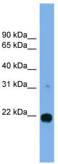 WB Suggested Anti-MITD1 Antibody Titration: 0.2-1 ug/ml; Positive Control: MCF7 cell lysate