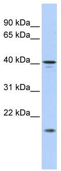 WB Suggested Anti-SLAIN1 Antibody Titration: 0.2-1 ug/ml; ELISA Titer: 1: 312500; Positive Control: HepG2 cell lysate