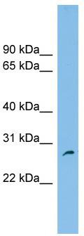 WB Suggested Anti-FAM109A Antibody Titration: 0.2-1 ug/ml; ELISA Titer: 1: 1562500; Positive Control: U937 cell lysate