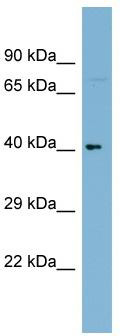 WB Suggested Anti-LRRC71 Antibody Titration: 0.2-1 ug/ml; Positive Control: THP-1 cell lysate