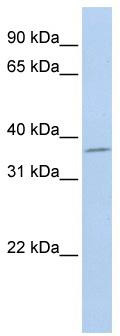 WB Suggested Anti-SLFNL1 Antibody Titration: 0.2-1 ug/ml; ELISA Titer: 1: 312500; Positive Control: Jurkat cell lysate