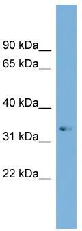 WB Suggested Anti-ARL13B Antibody Titration: 0.2-1 ug/ml; ELISA Titer: 1: 1562500; Positive Control: Jurkat cell lysate
