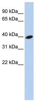 WB Suggested Anti-ARL13B Antibody Titration: 0.2-1 ug/ml; ELISA Titer: 1: 312500; Positive Control: 721_B cell lysate