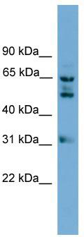 WB Suggested Anti-WDR16 Antibody Titration: 0.2-1 ug/ml; ELISA Titer: 1: 312500; Positive Control: 293T cell lysate