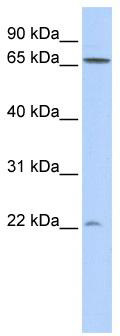 WB Suggested Anti-DIRAS1 Antibody Titration: 0.2-1 ug/ml; ELISA Titer: 1: 1562500; Positive Control: 293T cell lysate