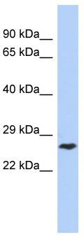 WB Suggested Anti-DIRAS1 Antibody Titration: 0.2-1 ug/ml; ELISA Titer: 1: 62500; Positive Control: Jurkat cell lysate