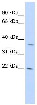 WB Suggested Anti-DDIT4L Antibody Titration: 0.2-1 ug/ml; ELISA Titer: 1: 12500; Positive Control: 293T cell lysate