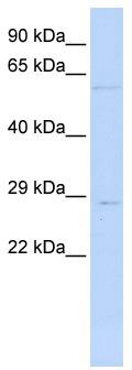WB Suggested Anti-MRPL10 Antibody Titration: 0.2-1 ug/ml; ELISA Titer: 1: 312500; Positive Control: Jurkat cell lysate