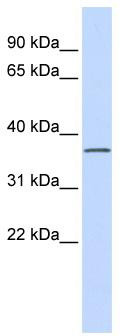 WB Suggested Anti-LRRC25 Antibody Titration: 0.2-1 ug/ml; ELISA Titer: 1: 62500; Positive Control: Human brain