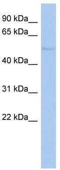 WB Suggested Anti-TIGD4 Antibody Titration: 0.2-1 ug/ml; ELISA Titer: 1: 62500; Positive Control: HepG2 cell lysate